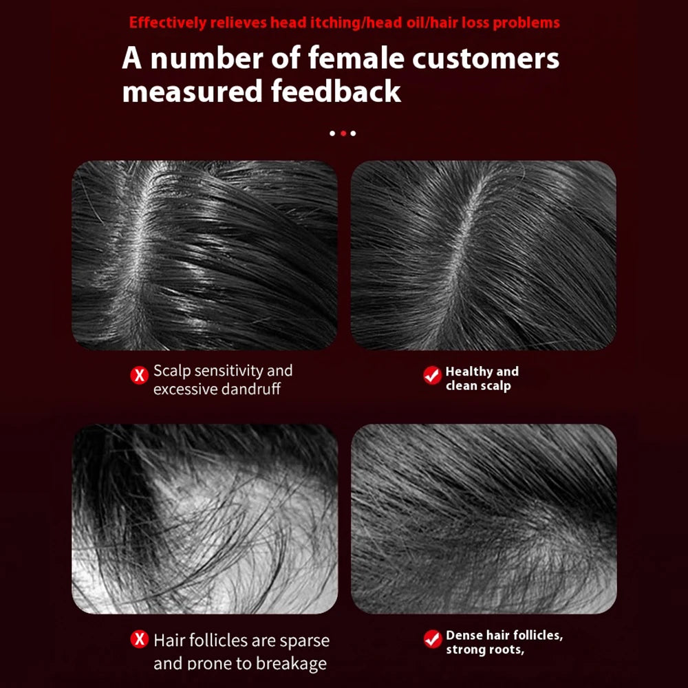 GlamRelax ™ Electric Massage Brush with Red Light for Hair Growth and Scalp Care